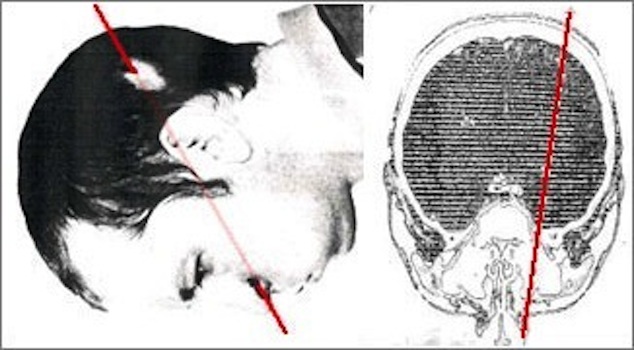 L’uomo che mise la testa in un acceleratore di particelle