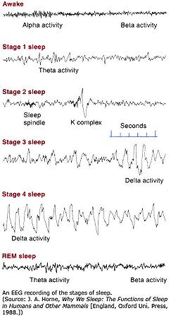 EEG