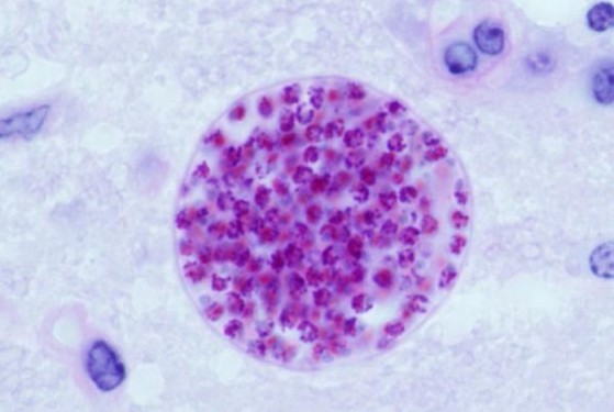 Toxoplasma gondii