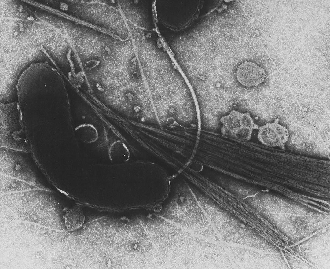 John Snow e l’epidemia di colera di Londra