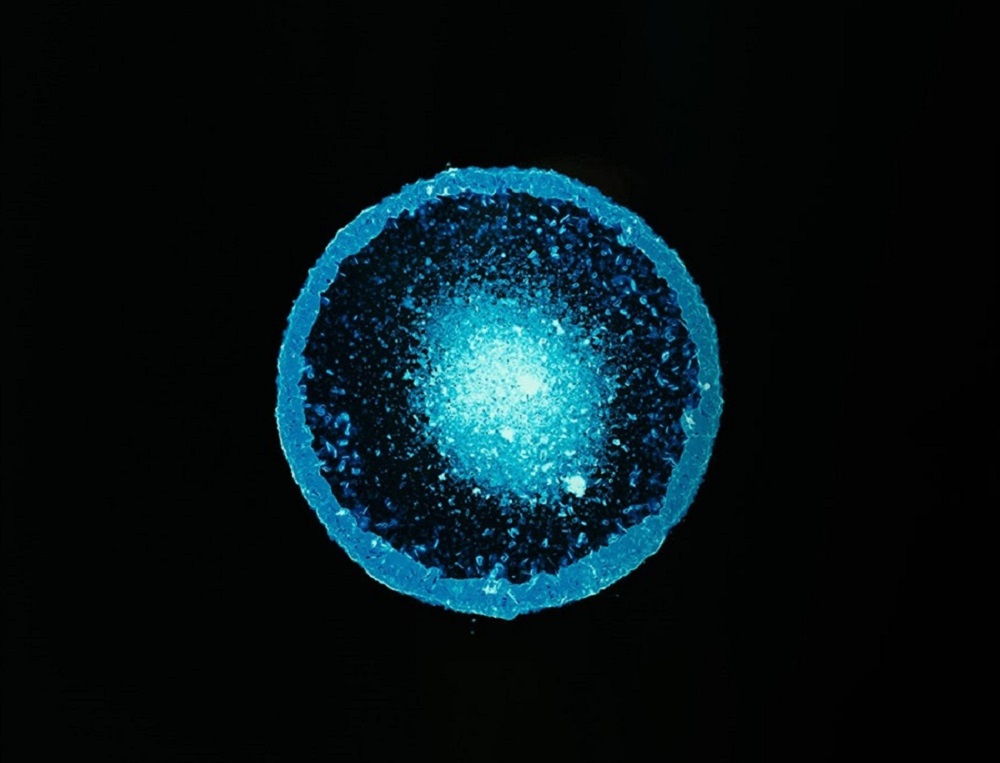 Dall’Eroina al Parkinson: il caso dell’MPTP e i Frozen Addicts