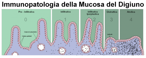 Immunopatologia della mucosa intestinale