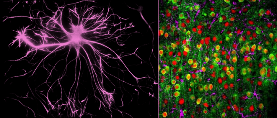 Un astrocita (cioè cellula a forma di stella) solo  e in mezzo a neuroni (verdi con il nucleo rosso)
