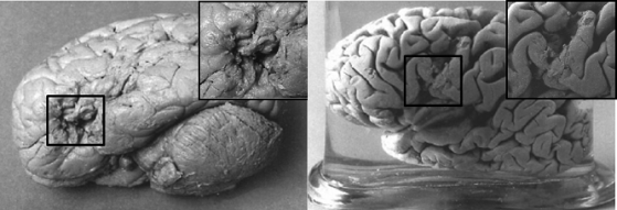 I cervelli di Tan (a destra) e Lelo (a sinistra). 