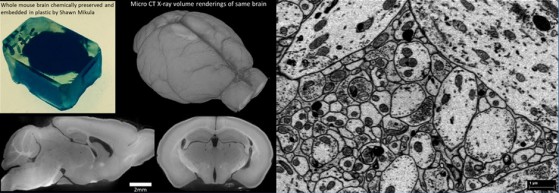 Conservazione del cervello di un topo tramite tecnica BROPA