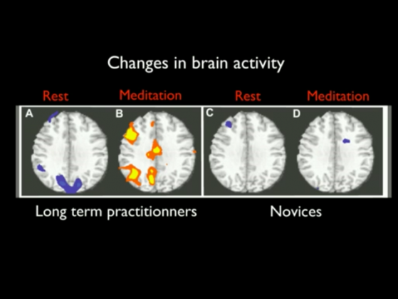 MeditationBrain