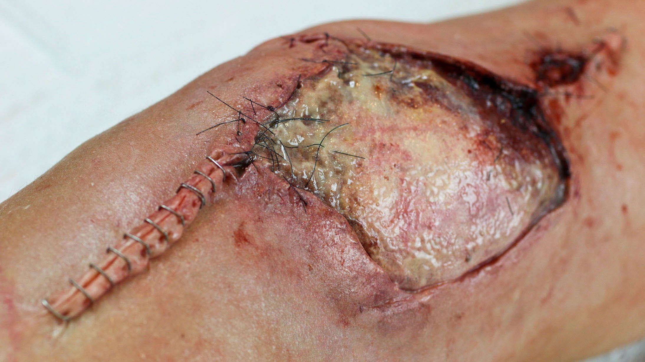 Come ti trucco il ginocchio