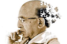 Trovato il legame tra Alzheimer e perdita della memoria