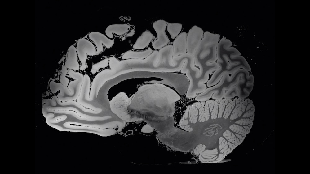 Una risonanza magnetica effettuata con un nuovo dispositivo mostra il cervello umano con dettagli mai visti