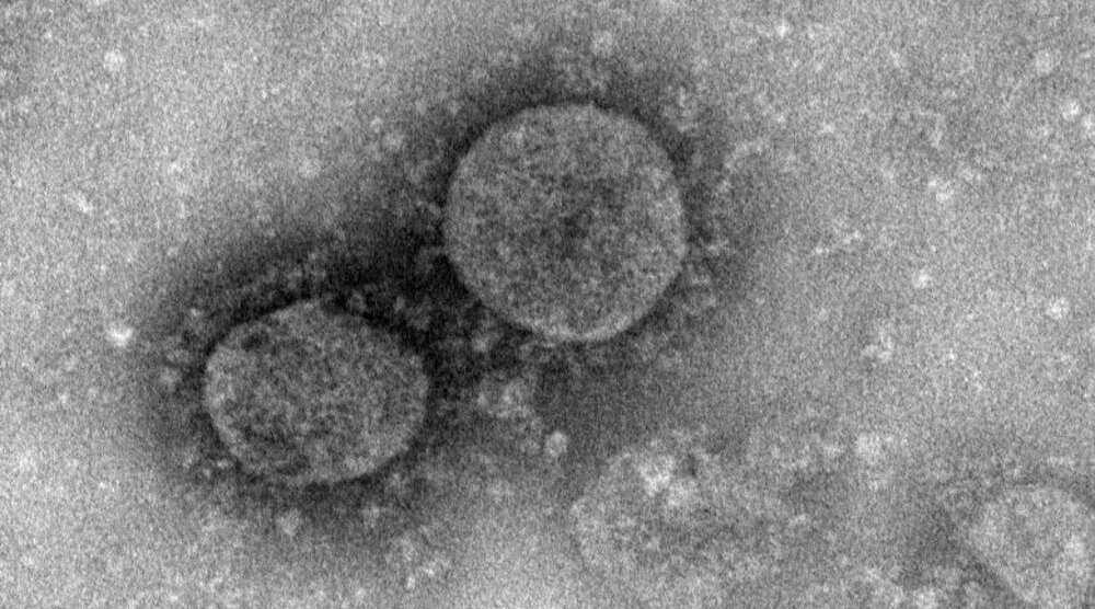 Coronavirus: le prime immagini del virus 2019-nCoV