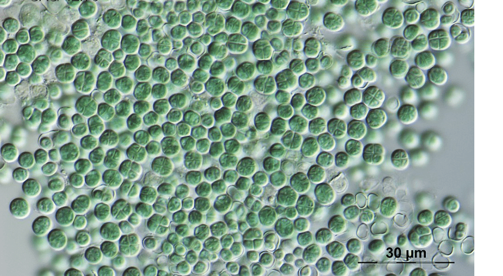 Vita microbiotica in profondità nella crosta terrestre sotto gli abissi
