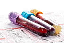 Un’esame del sangue permetterebbe di rivelare il cancro agli stadi iniziali
