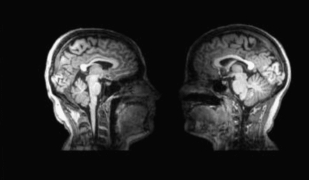 Contatto fisico: grazie alla risonanza magnetica si vede come viene percepito nel cervello