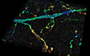 Guardare dentro al cervello come mai prima d’ora