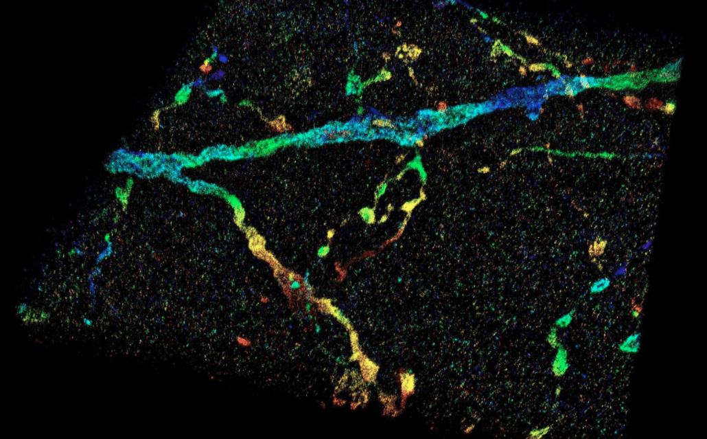Guardare dentro al cervello come mai prima d’ora