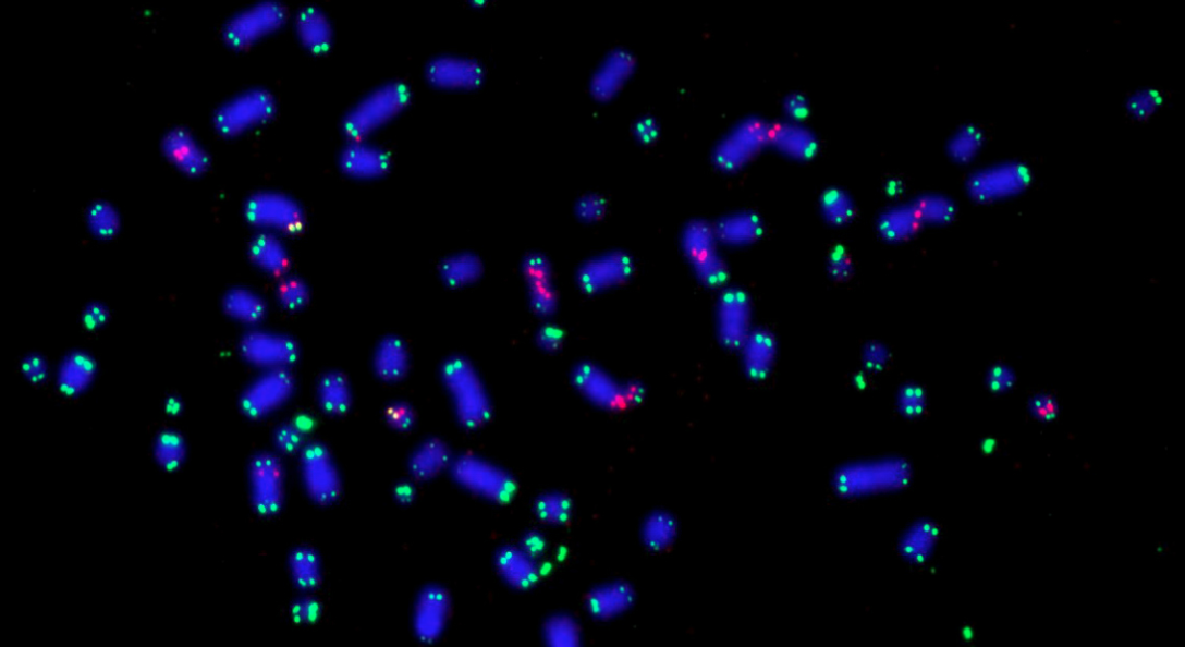 Cellule tumorali: scoperta una proteina che le aiuta a sopravvivere