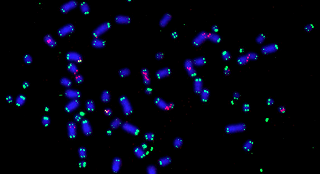 Cellule tumorali: scoperta una proteina che le aiuta a sopravvivere