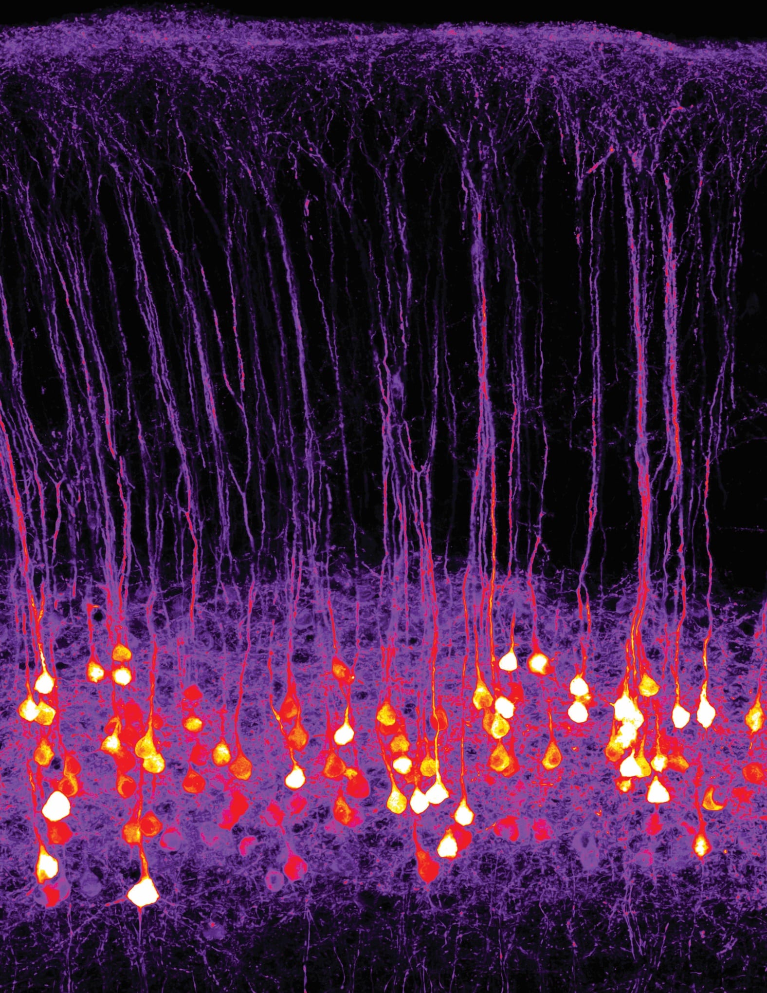 Olfatto: con l'optogenetica si può trasmettere un odore artificiale al cervello