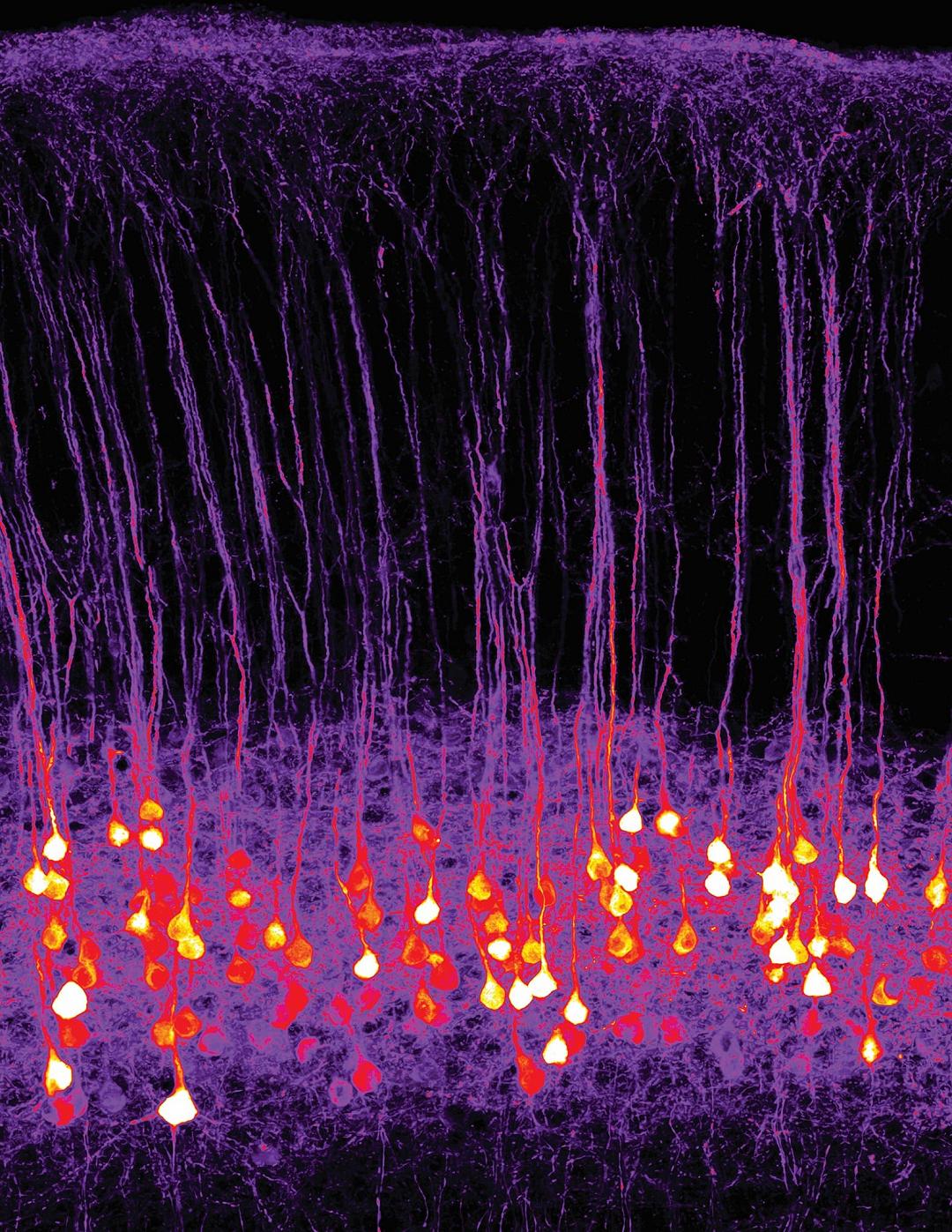 Olfatto: con l’optogenetica si può trasmettere un odore artificiale al cervello