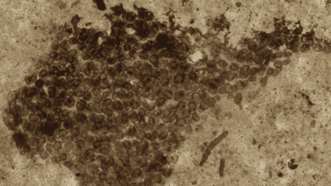 Microfossili: con la spettroscopia si risale all’inizio della vita sulla Terra