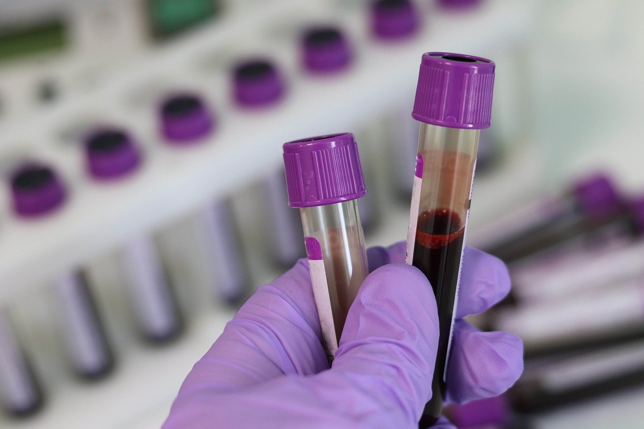 Pandemie: un osservatorio globale del sangue per fermarle, si potrebbe partire con il Coronavirus