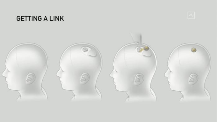 neuralink