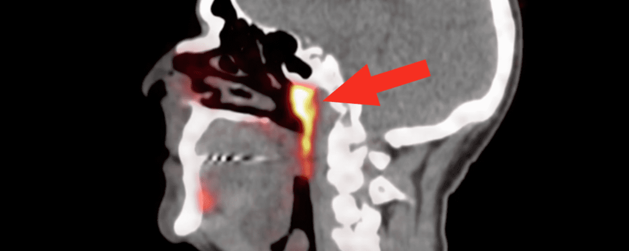 Anatomia: scoperte nuove ghiandole salivari?