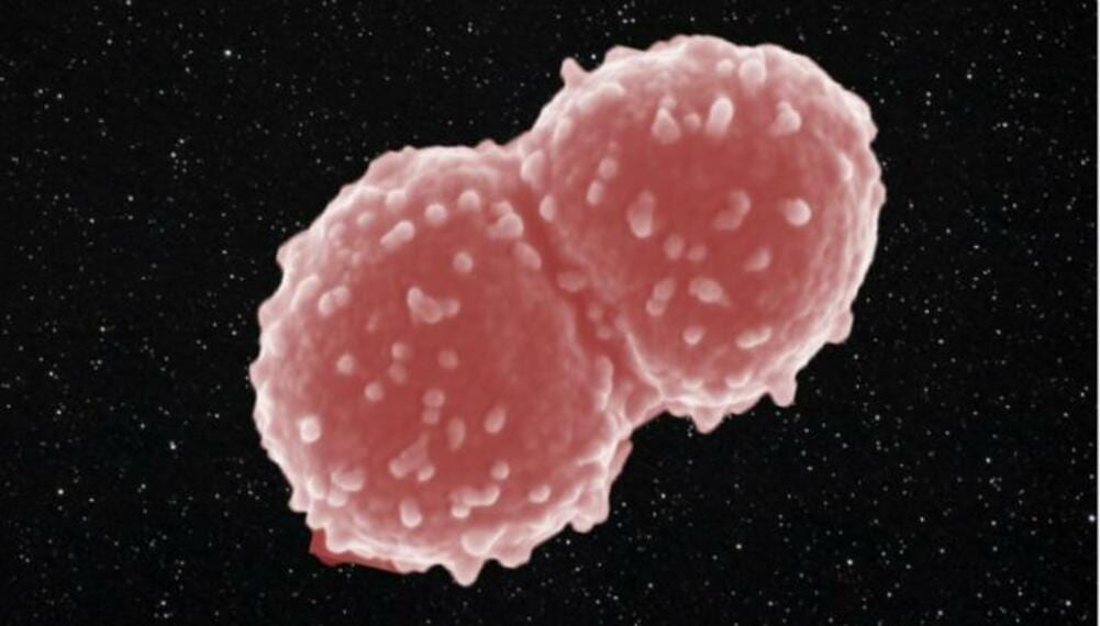 Deinococcus radiodurans: come il batterio sopravvive nello spazio