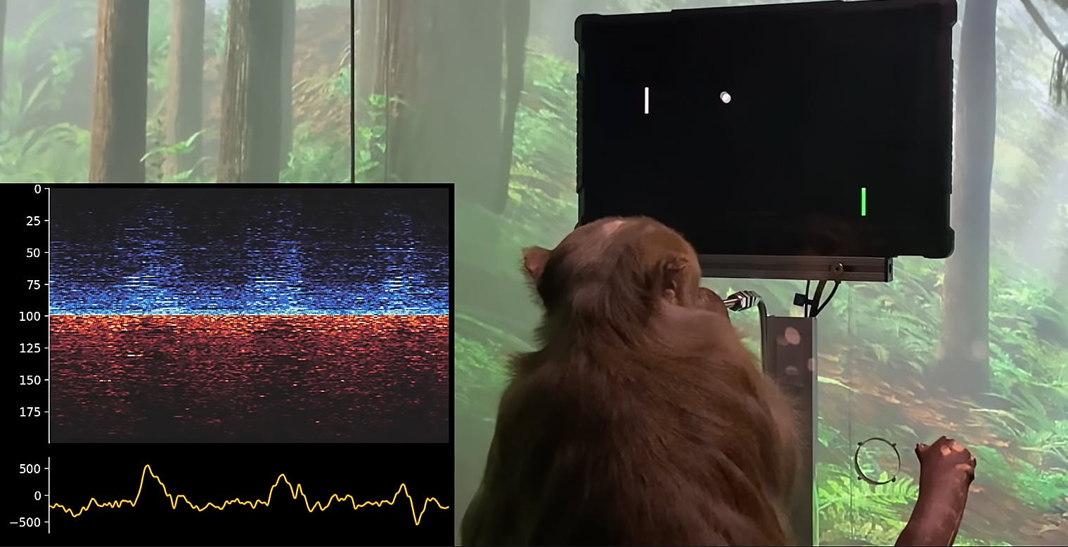 Neuralink, il video del macaco che gioca a Pong usando la mente