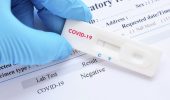 Covid: un guarito su tre non ha più anticorpi dopo un anno