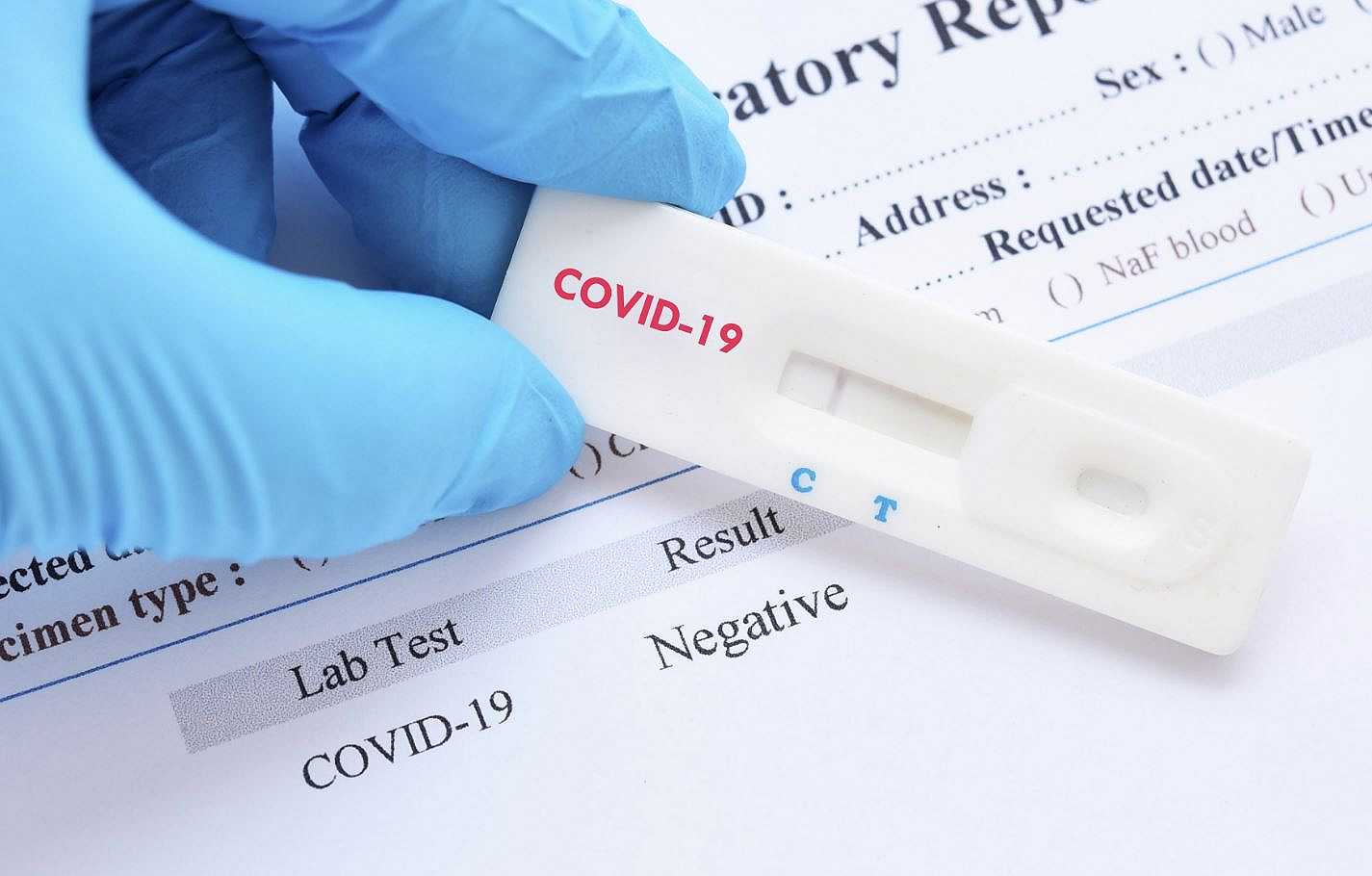 Covid-19, negli USA Amazon limita la quantità di test fai-da-te acquistabili