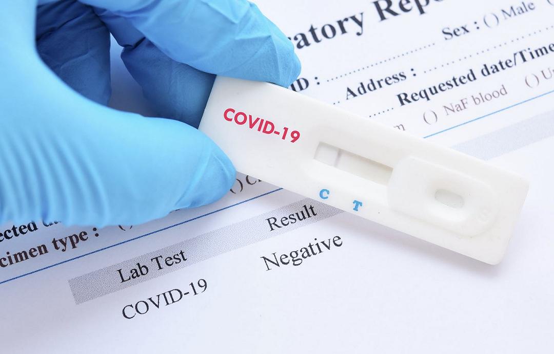Covid-19, negli USA Amazon limita la quantità di test fai-da-te acquistabili