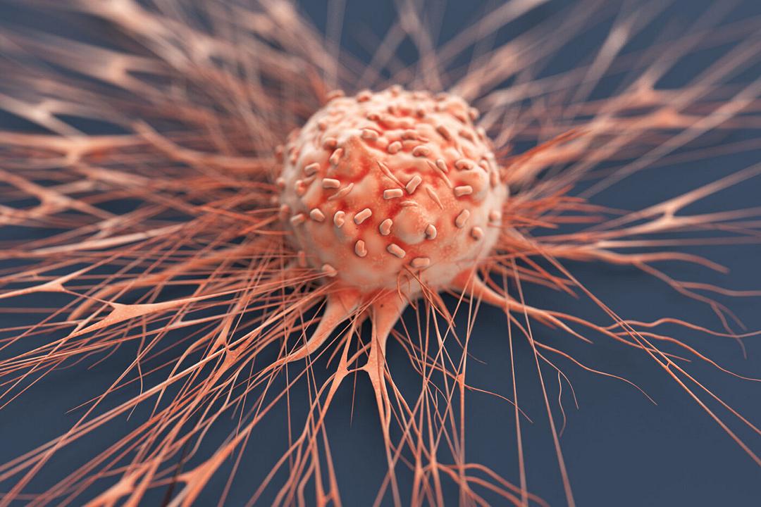 Tumore sistema nervoso: in aiuto un farmaco per l’epilessia