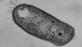 Batteri: scoperta specie che si nutre sia di zolfo che di metano