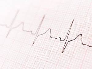 Fibrillazione atriale: nuova tecnologia stabilizza il ritmo del cuore