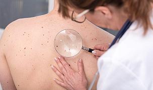 Melanoma: il rischio potrebbe aumentare vivendo in montagna