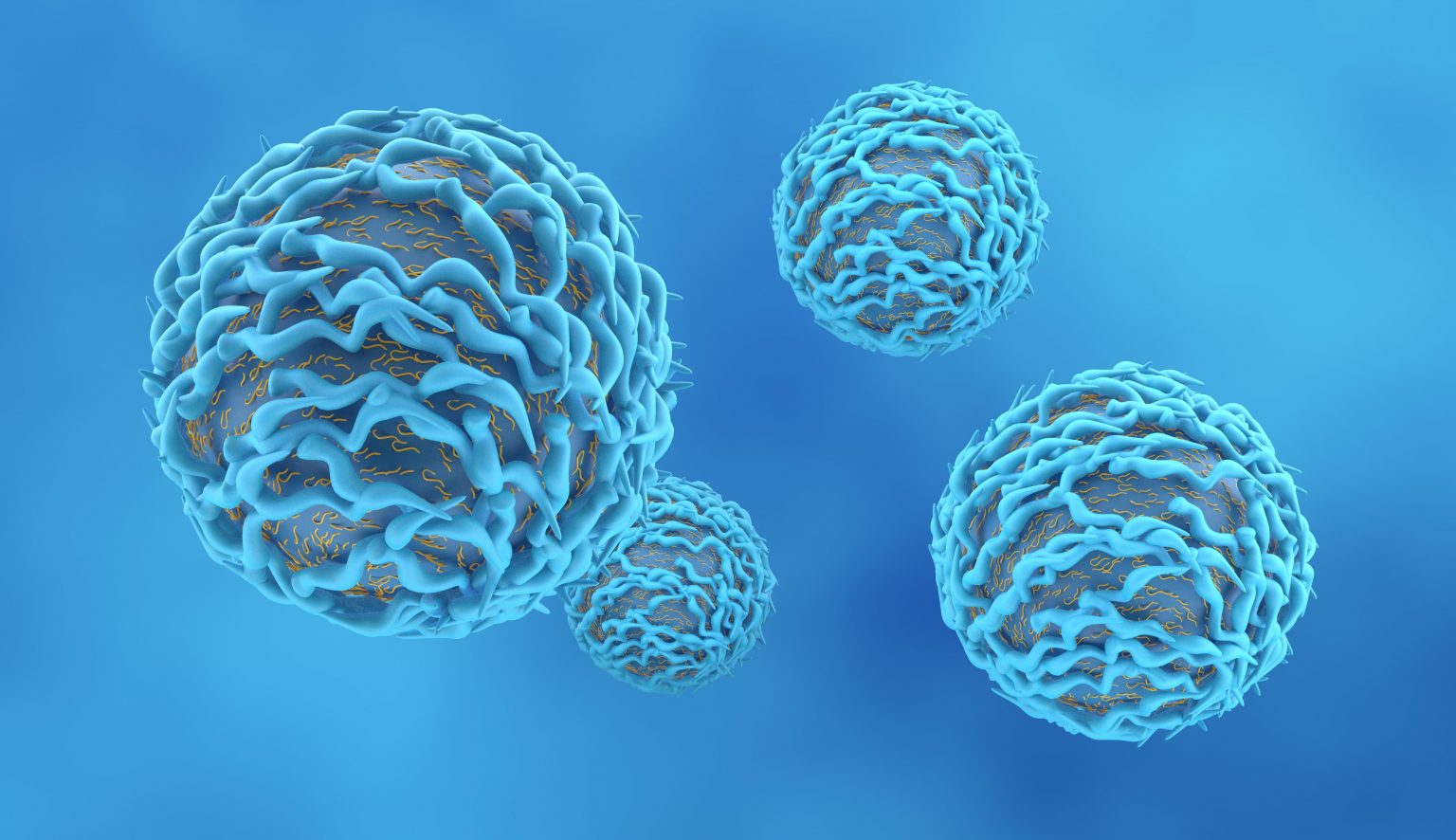 Gammopatia monoclonale: ecco il perché del suo nome