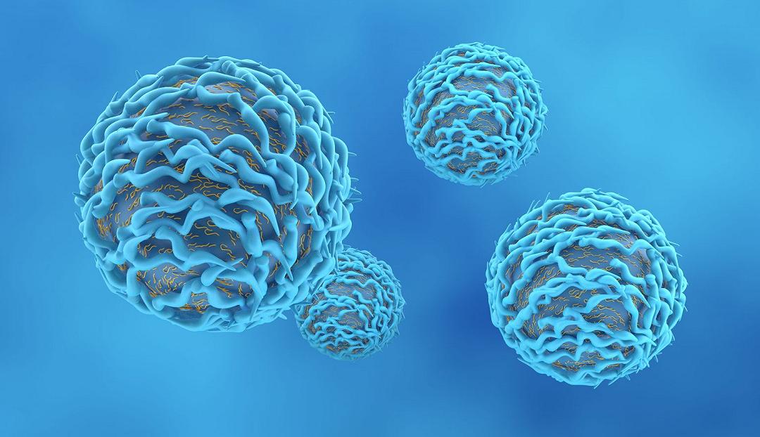 Gammopatia monoclonale: ecco il perché del suo nome