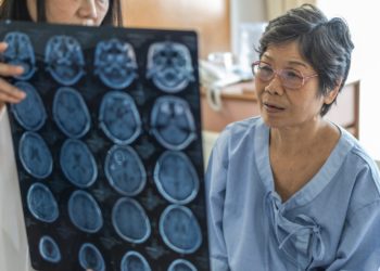Alzheimer: test del sangue limita i danni neurologici