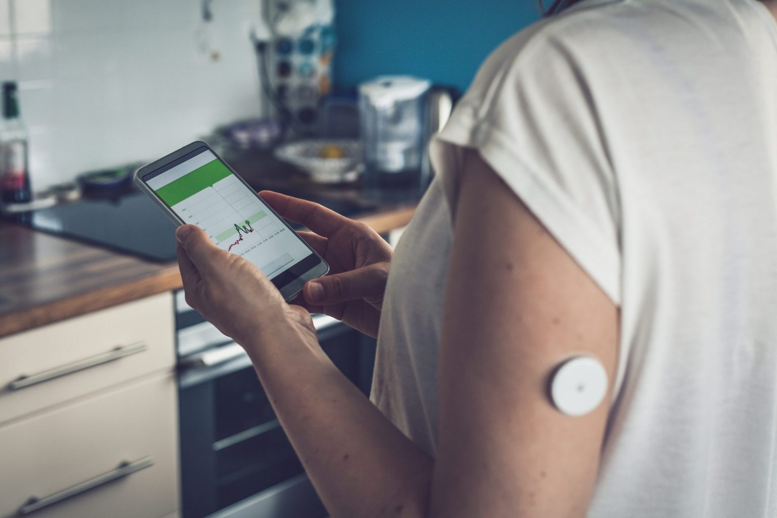 Diabete di tipo 1: trattamento agevolato dalla rivoluzione digitale
