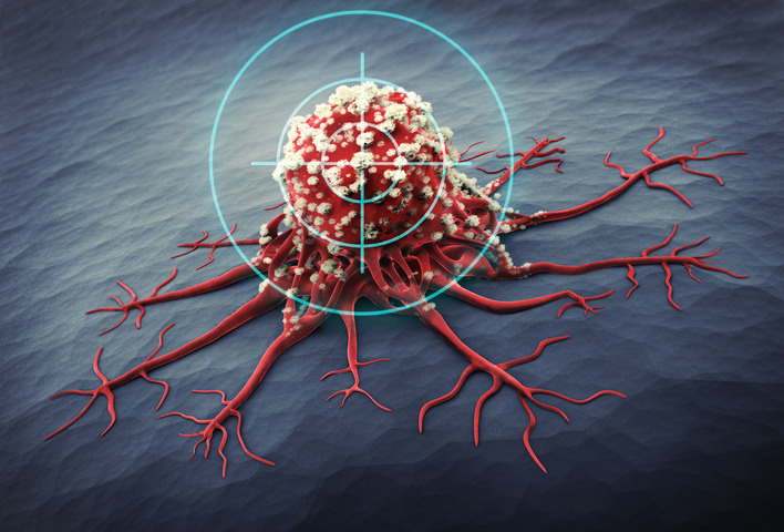L’Innovativa chemioterapia che non lascia tracce