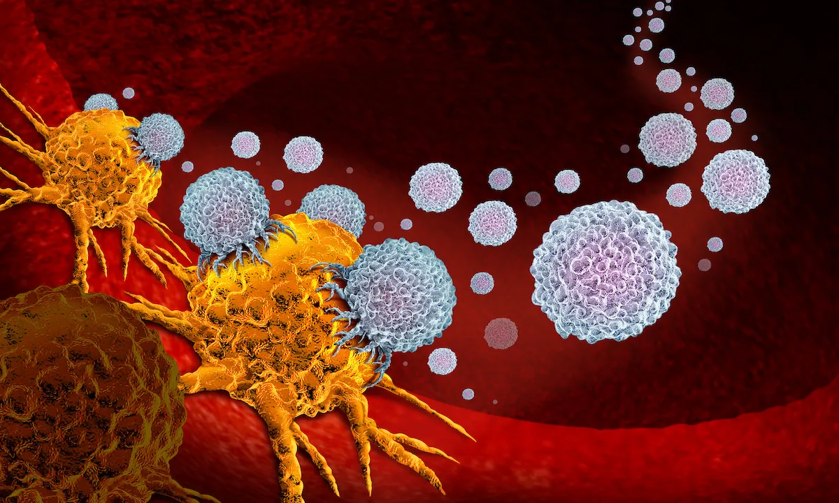 Cancro, gli ultrasuoni eliminano la necessità di trattamenti invasivi