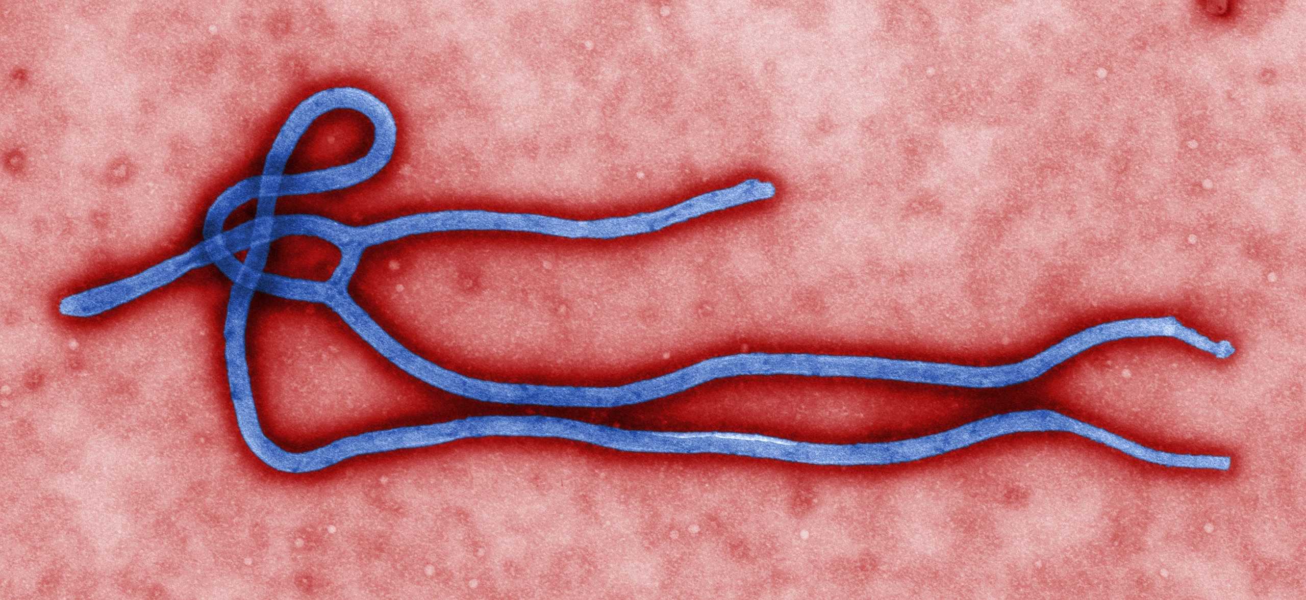I regimi vaccinali contro l’ebola sono sicuri negli adulti e nei bambini
