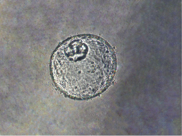 Un organoide ideato per sconfiggere il cancro gastroesofageo