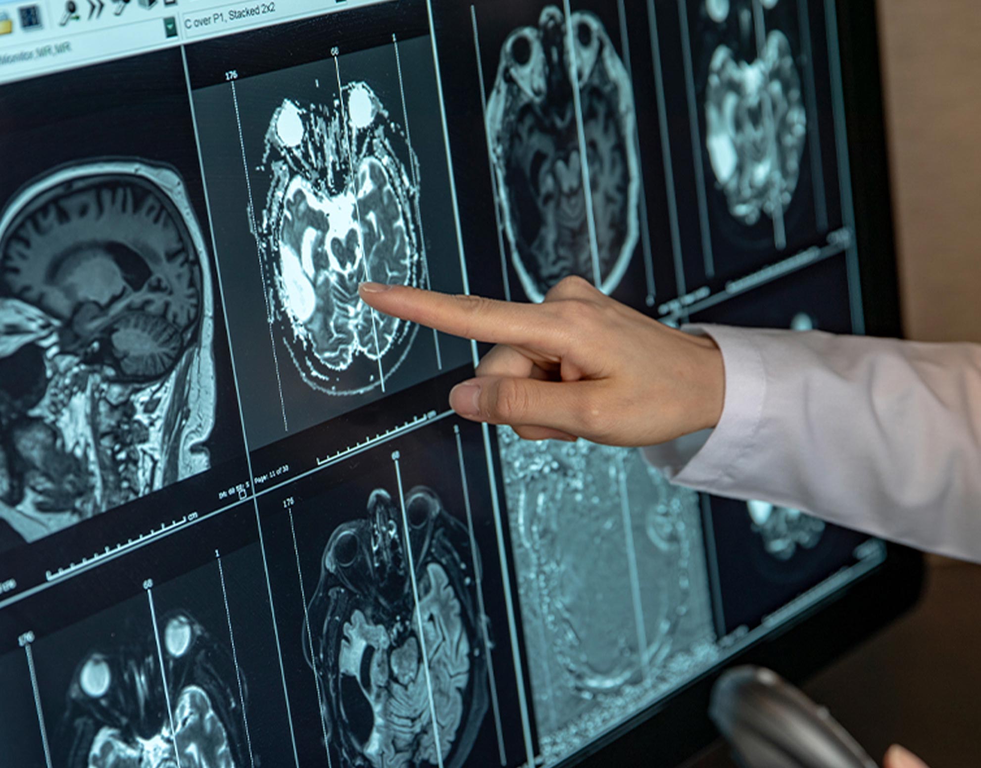 Un metodo di diagnosi che spinge il cancro ad auto-rivelarsi