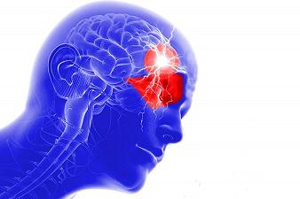 Le persone affette da cefalea a grappolo hanno maggiori probabilità di soffrire di altre malattie?