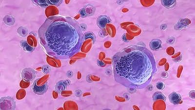 Uno studio dimostra l’efficacia di tre farmaci nei pazienti con leucemia linfatica