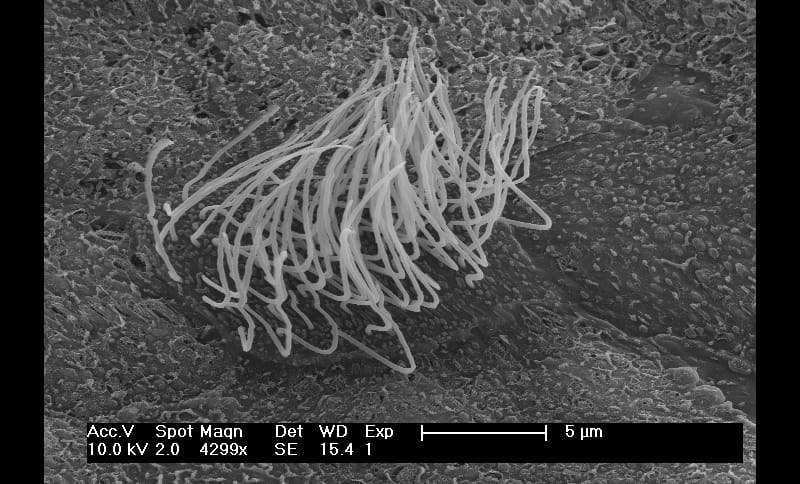 La percezione del mondo dipende anche dalle ciglia nelle cellule