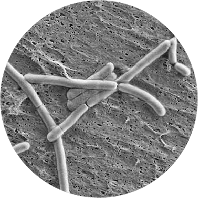 SLA, trovato un probiotico protettivo