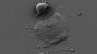 Le cellule tumorali cambiano taglia per sopravvivere